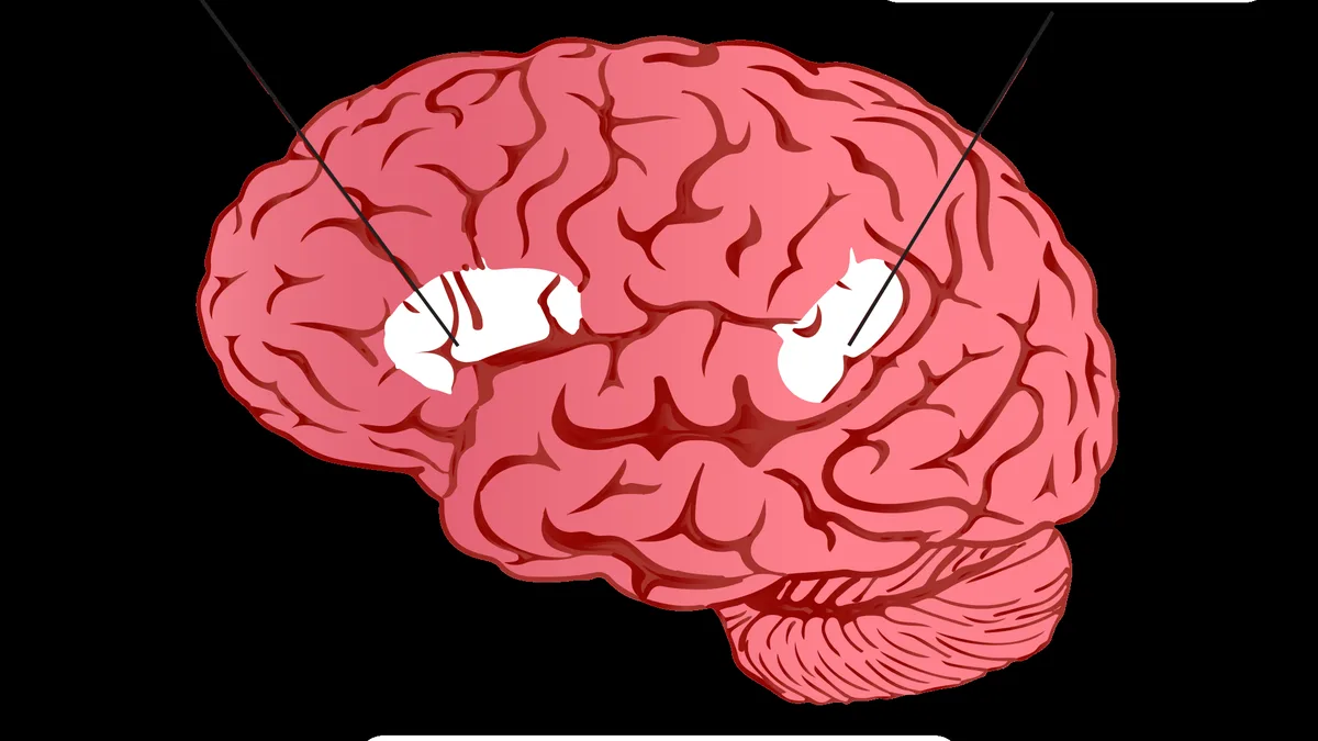 Speech And Language